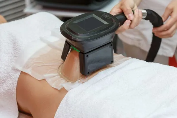 Image of person having fat freezing treatment to help weight gain Henley-on-Thames