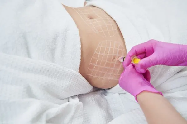 image of fat dissolving injections on love handles to help combat weight gain Henley-on-Thames