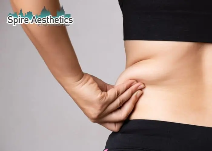 Image of woman pinching fat on their hips Henley-on-Thames. Fat Freezing treatment