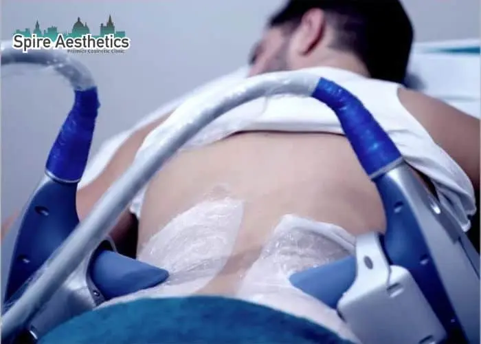 Man having fat freezing treatment done on love handles before a competitions Henley-on-Thames to create a sculpted look.