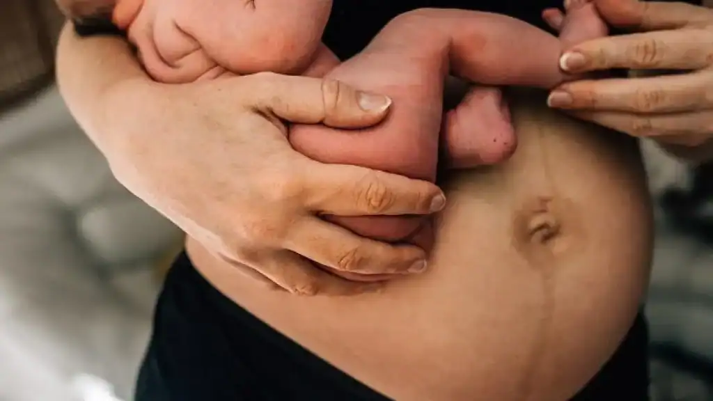 Why Is My Stomach Still Big After Pregnancy Henley-on-Thames?