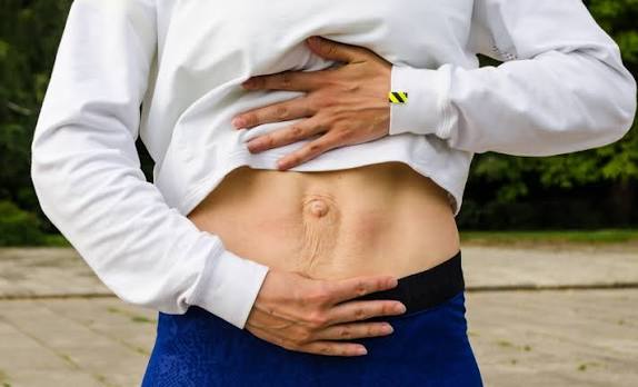 When Could Diastasis Recti Be the Missing Piece of the Puzzle Henley-on-Thames?